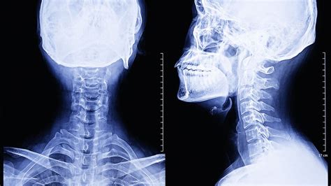 lethal throat|Punched in the throat: What happens, treatment, and getting help.